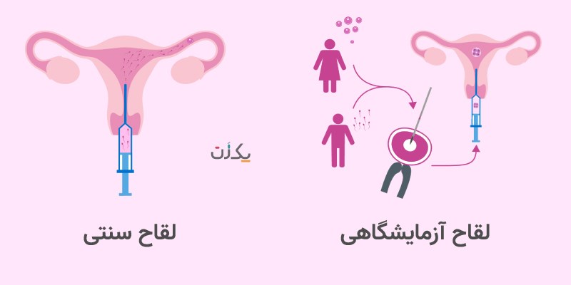 آیا لقاح مصنوعی حرام است؟