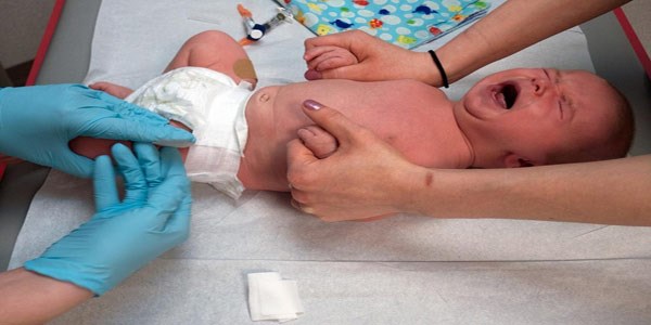 تشنج های نوزادی (Neonatal seizures)