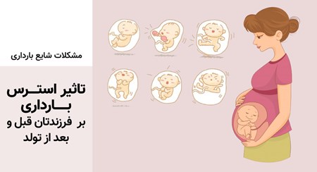 تاثیر استرس  بارداری بر  فرزندتان قبل و بعد از تولد